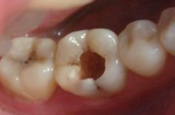 坐月子可以洗澡洗牙吗剖腹产后怎么办,科学护理，健康恢复